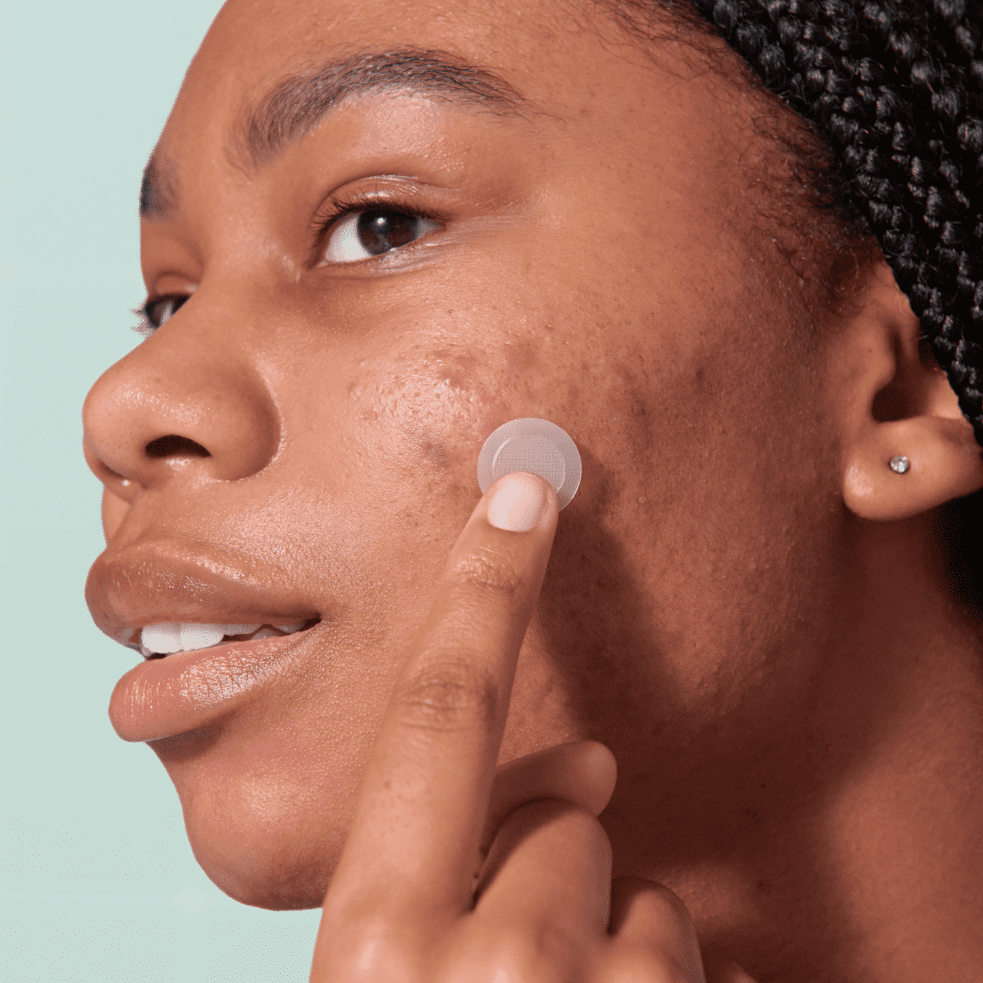 Mighty Patch™ for Early-Stage Blemishes - Fresh Touch