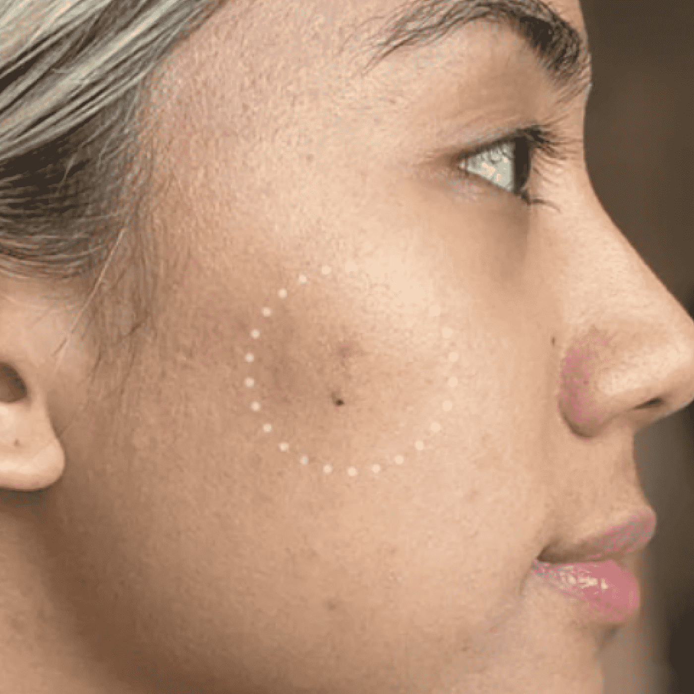 Mighty Patch™ for Dark Spots - Bright Balance