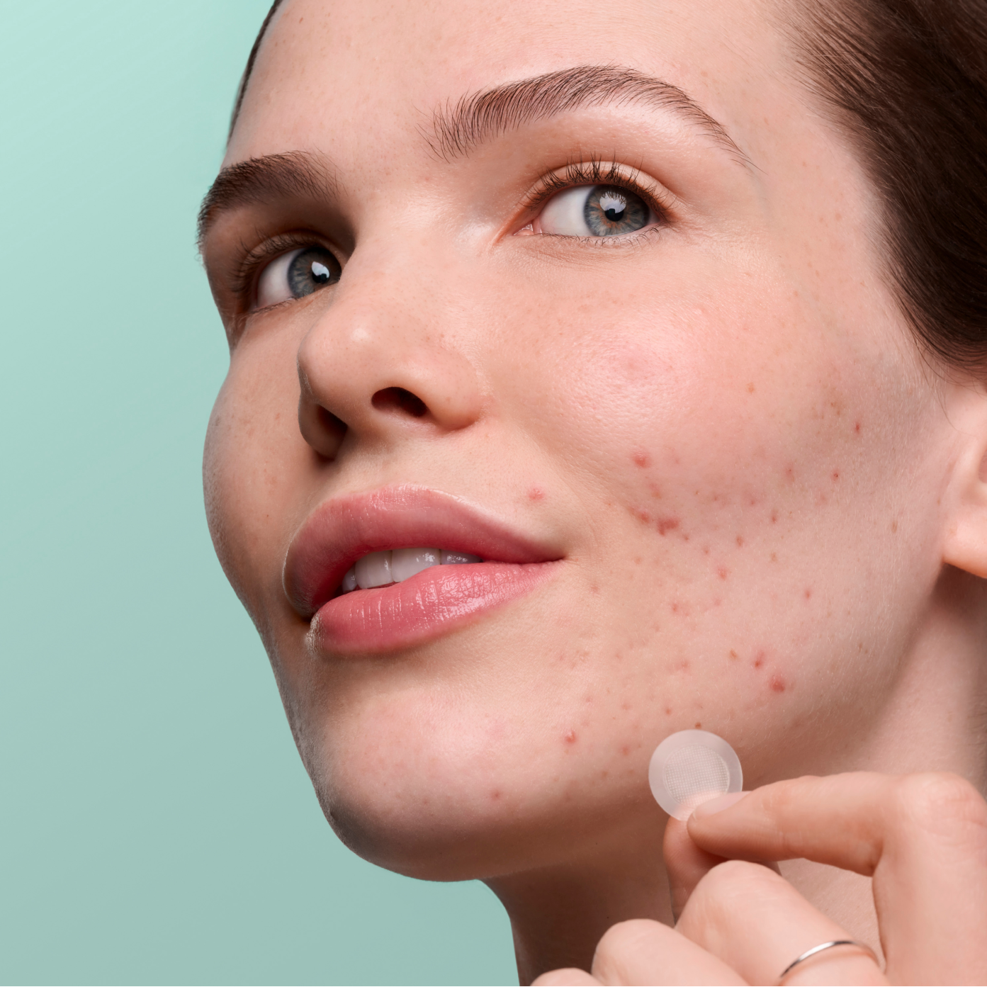 Pimple Patrol Duo - Fresh Touch